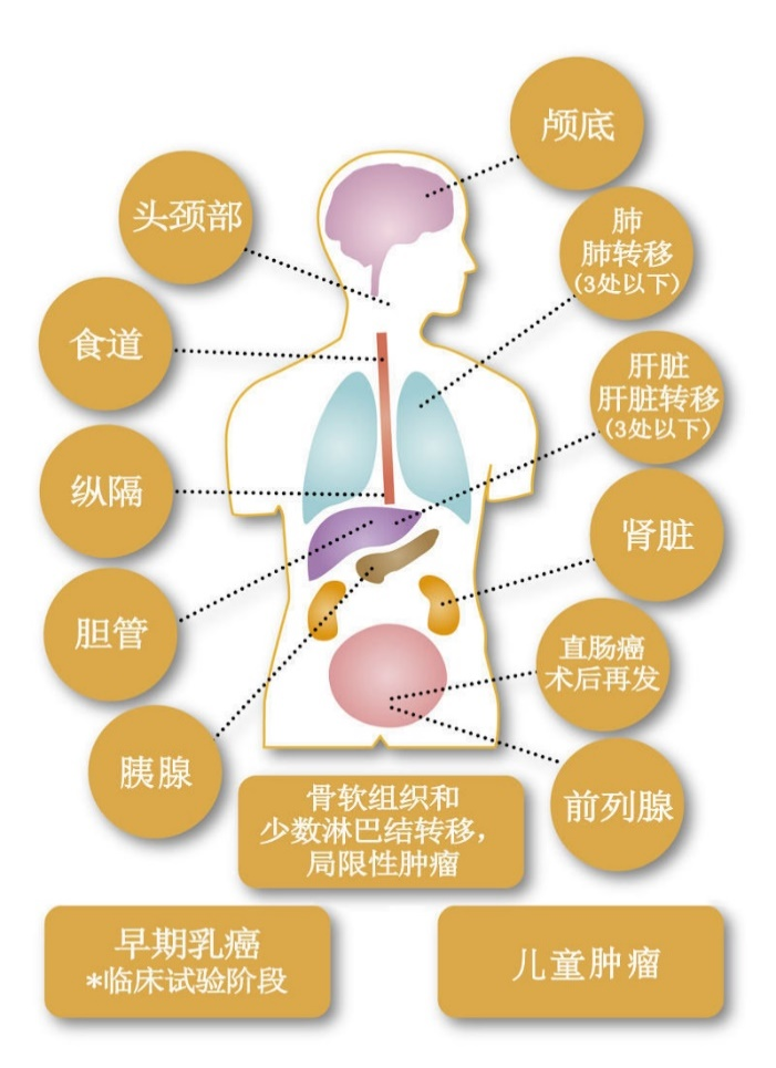 质子线治疗范围
